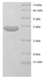 SDS-PAGE