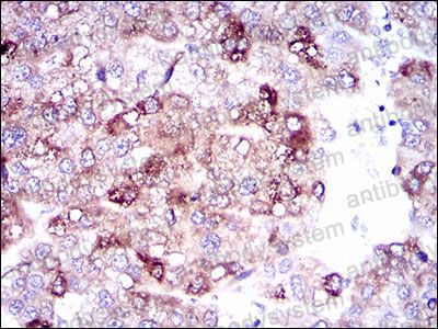 Валидация AntibodySystem RHN99802 (4056)