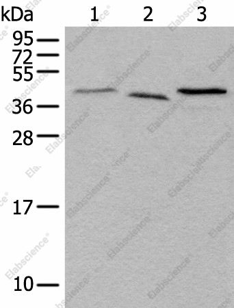 Вестерн-блоттинг, UBXN1, ткань мозга мыши и клетки HeLa, HEPG2
