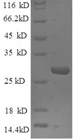 SDS-PAGE