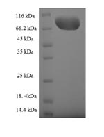 SDS-PAGE