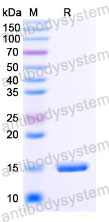 Валидация SDS-PAGE - AntibodySystem RHJ95101