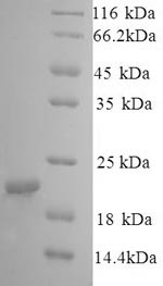SDS-PAGE