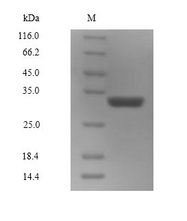 SDS-PAGE