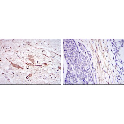 Валидация Affinity BF0624 - 5332