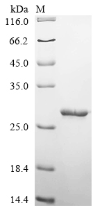 SDS-PAGE
