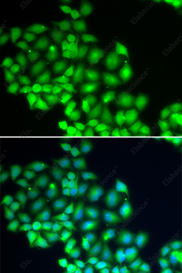 Иммунофлуоресценция, ERCC2, клетки HeLa