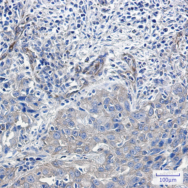 Валидация AntibodySystem RHE69701