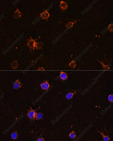 Иммунофлуоресценция, CD11B, клетки THP-1