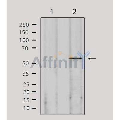 Валидация Affinity DF6844 - 18418