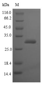 SDS-PAGE