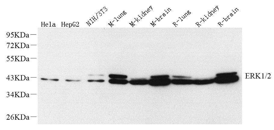 Вестерн-блоттинг, ERK1/2, различные образцы