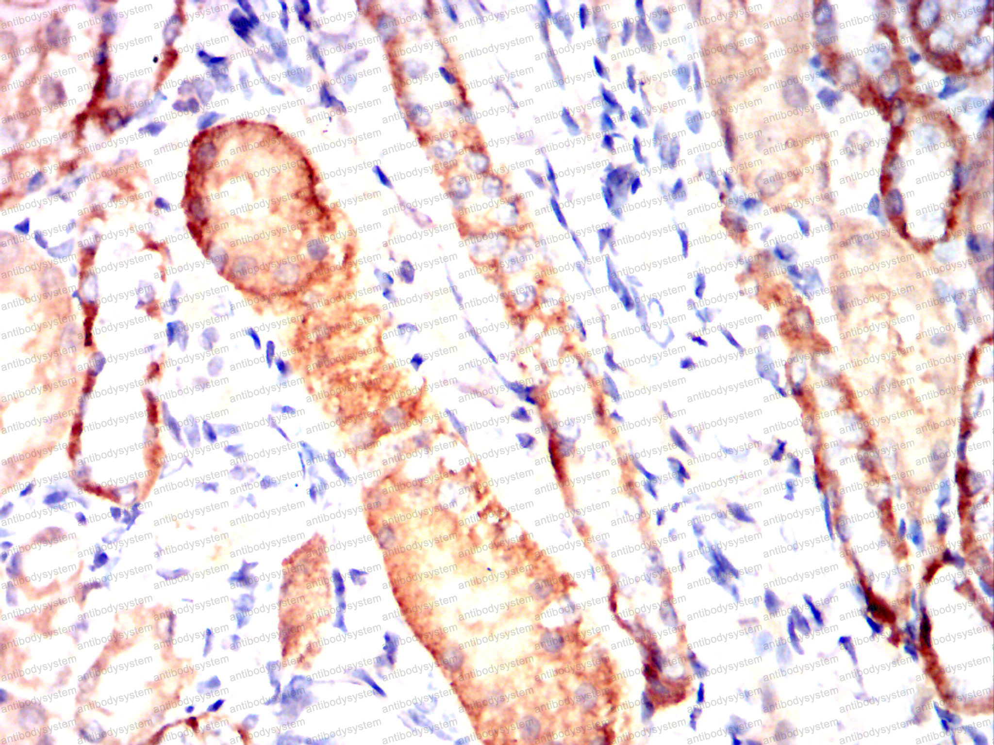Валидация AntibodySystem RHC33705 (923)