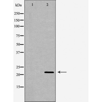 Валидация Affinity DF6453 - 17834