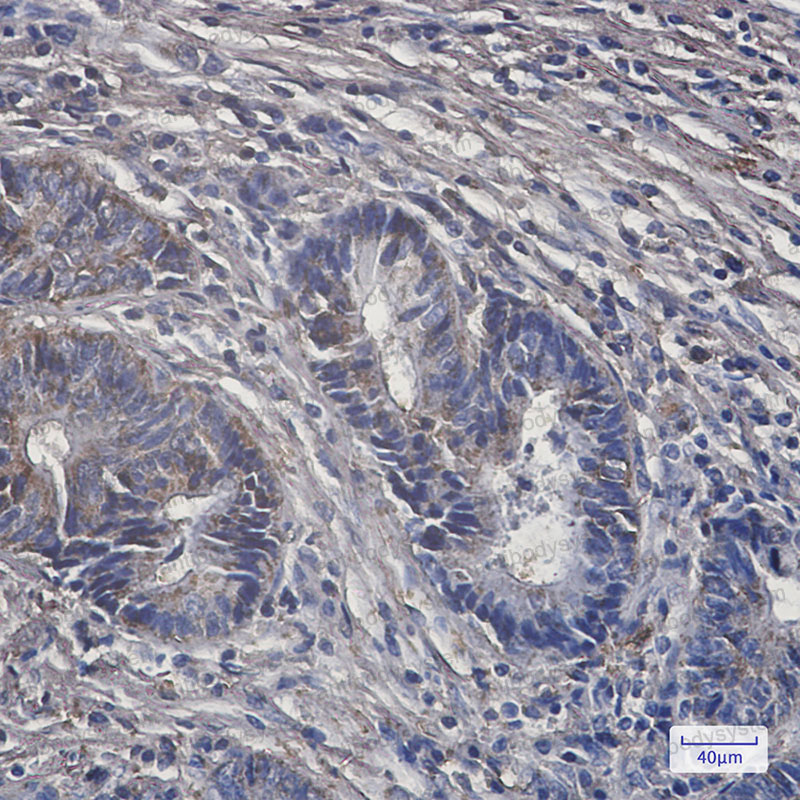 Валидация AntibodySystem RHH38001