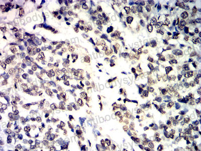 Валидация AntibodySystem RHB95603 (478)