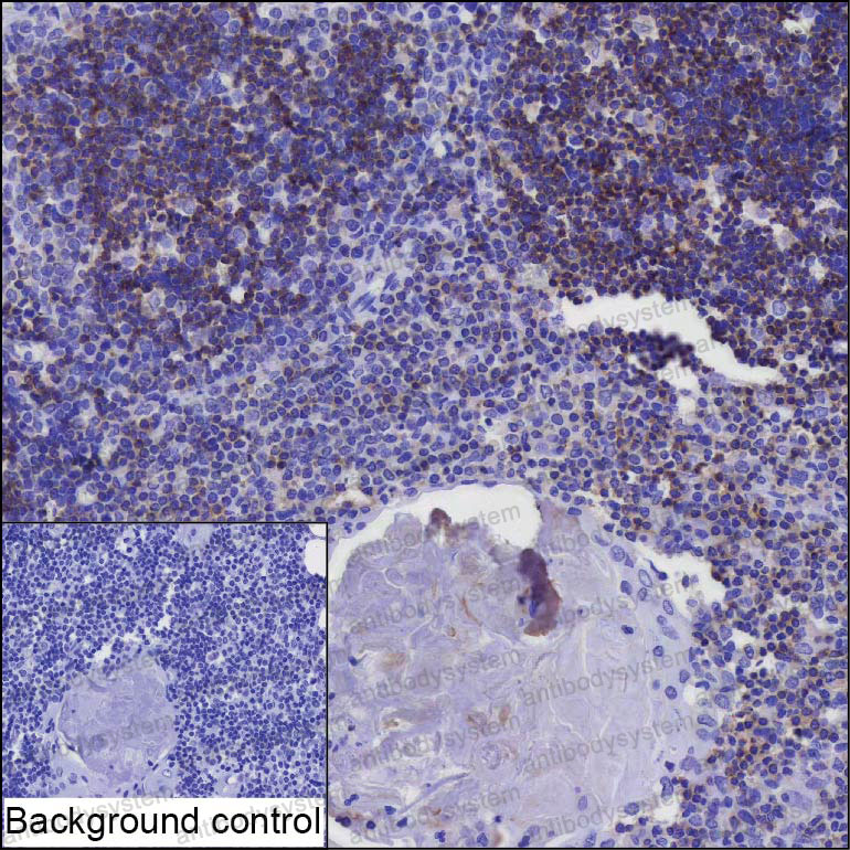 Валидация AntibodySystem RHP06801