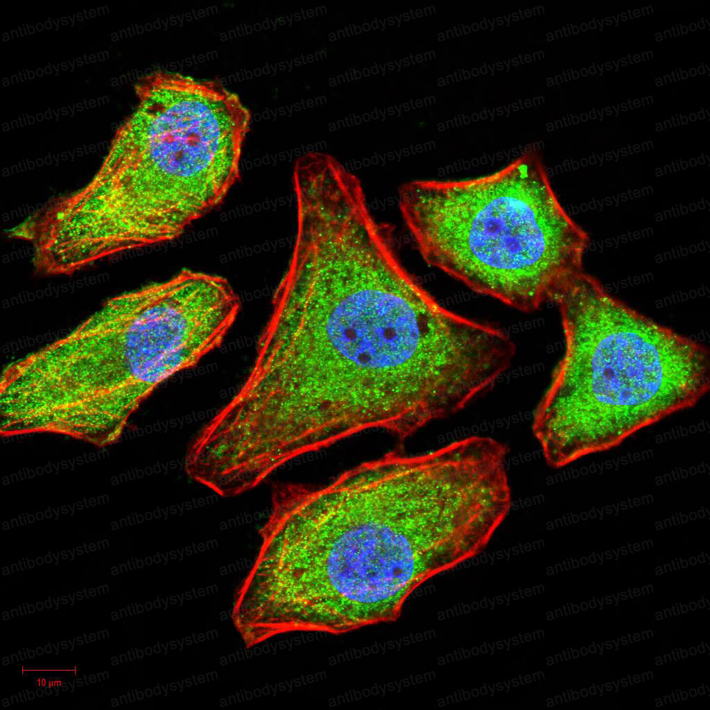 Валидация IF - AntibodySystem RHD03301