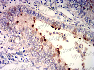 Валидация AntibodySystem RHH11501