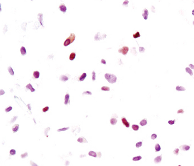 Валидация AssayVector ARM2557(4612)