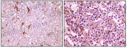 Валидация AntibodySystem RHJ47201
