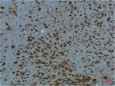 Валидация AntibodySystem RHD75806