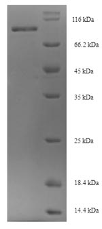 SDS-PAGE