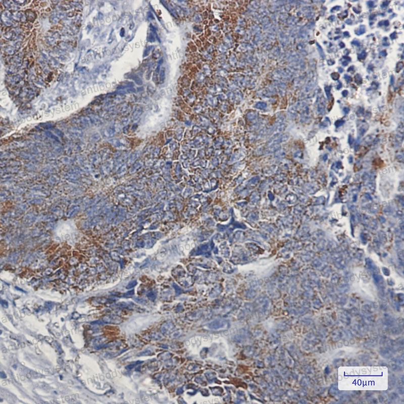 Валидация AntibodySystem RHN78801