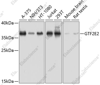 Вестерн-блоттинг, GTF2E2, различные клеточные линии