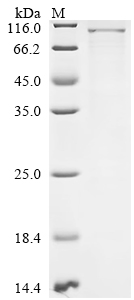 SDS-PAGE