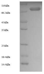 SDS-PAGE