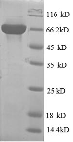 SDS-PAGE