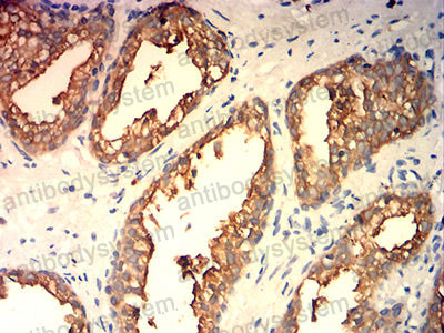 Валидация AntibodySystem RHD37702