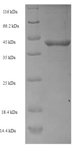 SDS-PAGE