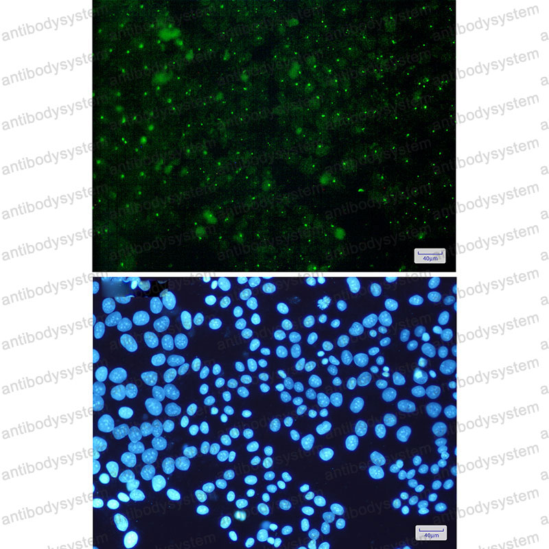 Валидация IF - AntibodySystem RHE16001