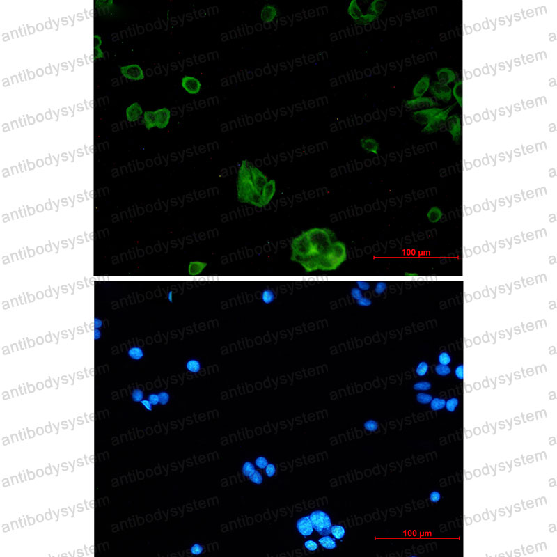 Валидация IF - AntibodySystem RHN80801