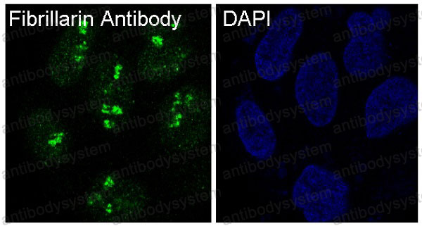 Валидация IF - AntibodySystem RHD50101