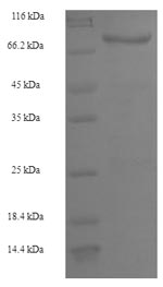 SDS-PAGE