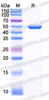 YHC21202, SDS-PAGE