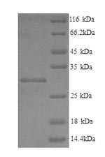 SDS-PAGE