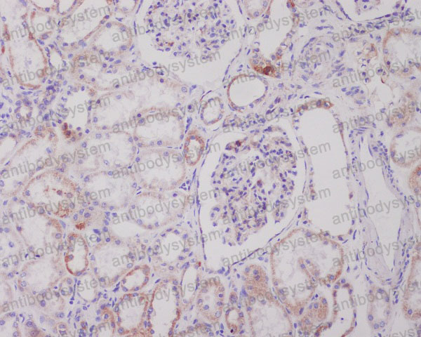 Валидация AntibodySystem RHJ24501