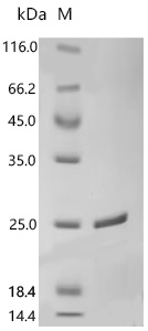 SDS-PAGE