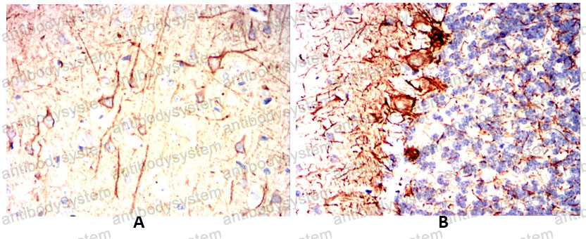 Валидация AntibodySystem RHC23301 (803)