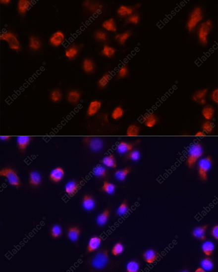 Иммунофлуоресценция, ACVR2A, клетки A431