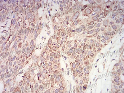 Валидация AntibodySystem RHD96512 (1880)