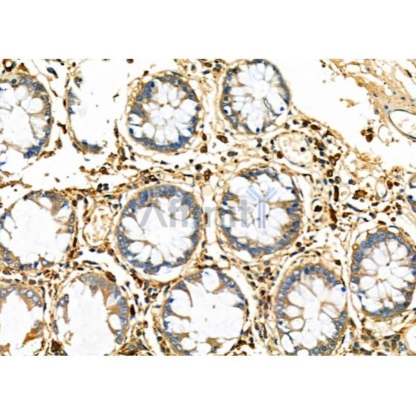 Валидация Affinity DF6604 - 18055