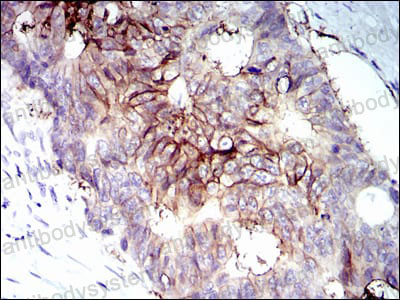 Валидация AntibodySystem RHC29906