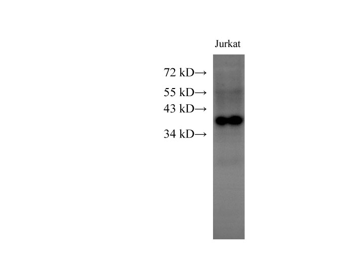 Вестерн-блоттинг, HMG20B, клетки Jurkat