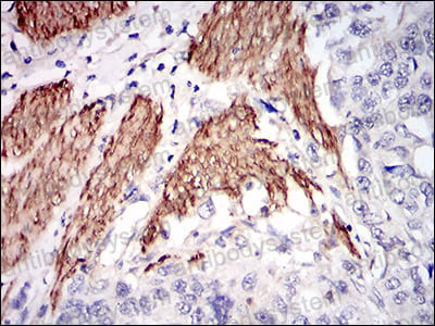 Валидация AntibodySystem RHA41902