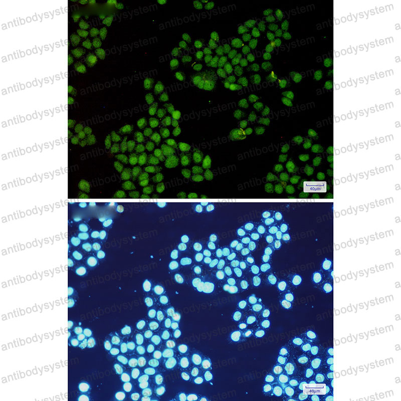 Валидация IF - AntibodySystem RHD64701